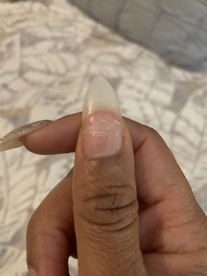 Day 3: Gel completely popped off, leaving exposed acrylic tip