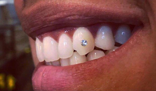 Teeth Gems. Swarovski $75.