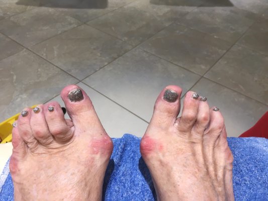 My (hideous) toes made bearable with expert pedicure and silver glitter polish.