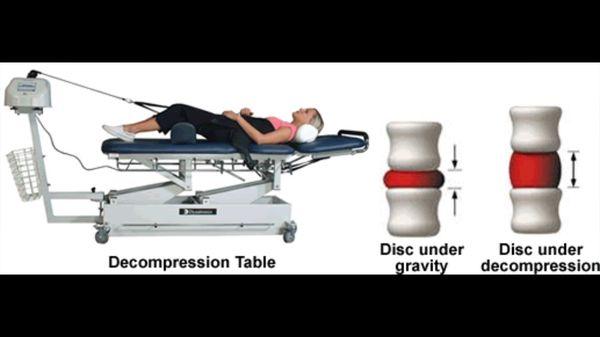 Spinal Decompression