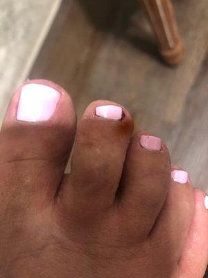 Injured my toe and not willing to take any responsibility for it. So unprofessional. Spend your time and money elsewhere