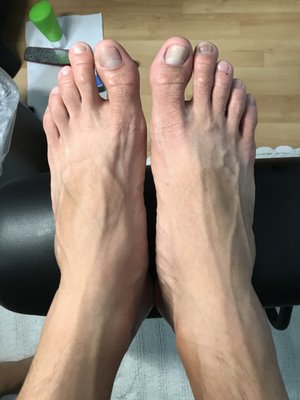 My hubby's feet after...nicer cleaner nails.