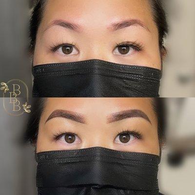 Brow correction