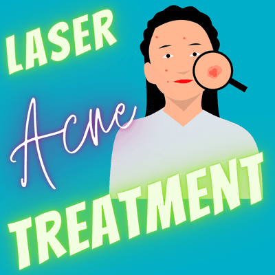 Laser Acne Treatment