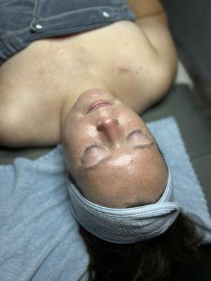 Glowy facial with dermaplane