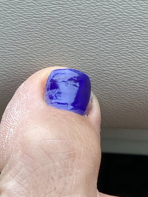 This is immediately after the pedicure - terrible bumps on nail and too much dry skin.