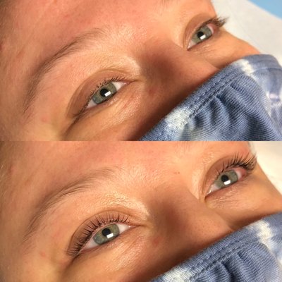 lash lift