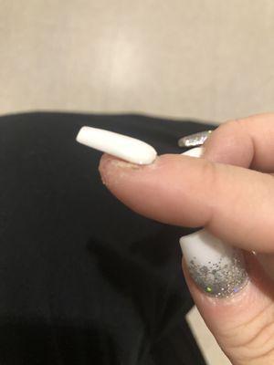 One week after new set - lifted entire nail