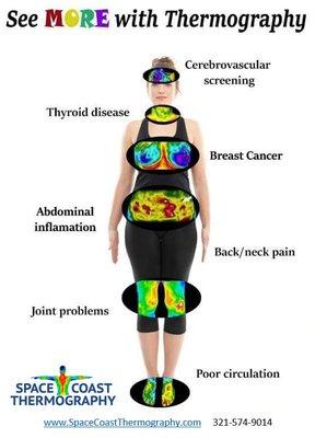 Thermography can see inflammation throughout the body alerting you of issues that should be addressed for good health.