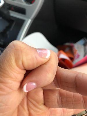 Bumps under nails