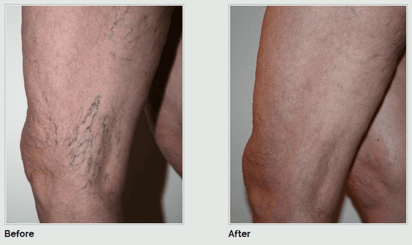 Advanced Dermatology P.C. | Island Vein Specialists