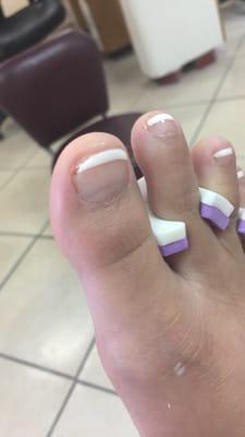 This is a picture of my big right toe