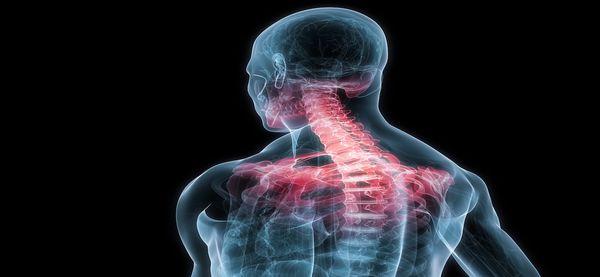 Kennedy Chiropractor Wellness Center, Union City NJ, Neck Pain