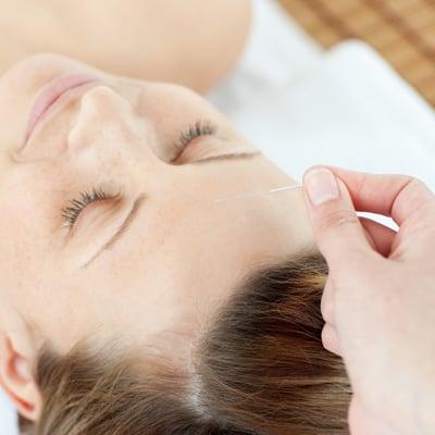 Most patients find the acupuncture session very relaxing.