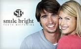 Smile Bright Teeth Whitening