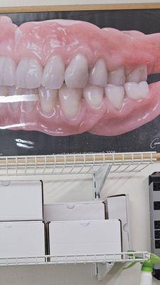 Dentures implant builders for beautiful smiling, perfect fit for any adjustments.