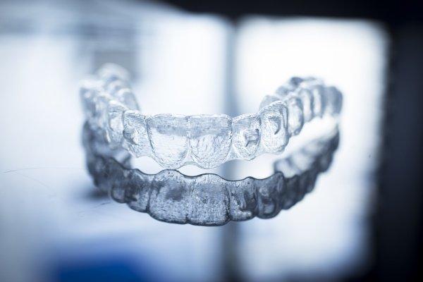 Clear Aligners