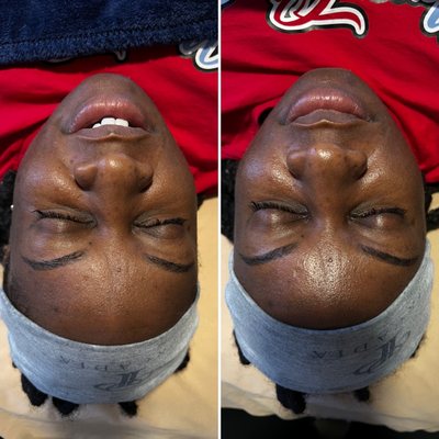 Before and after the hydrating strawberry shortcake facial!