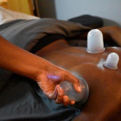 Cupping therapy