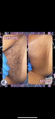 $40 BRAZILIAN WAXING