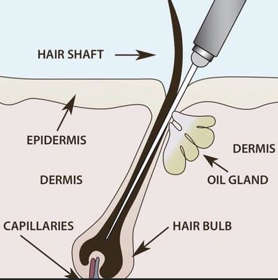 Electrolysis