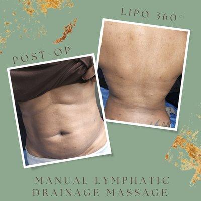 Manual Lymphatic Drainage Massages!