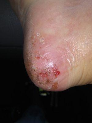 I went and had a pedicure there and went to my foot doctor so i got foot fungus from there.