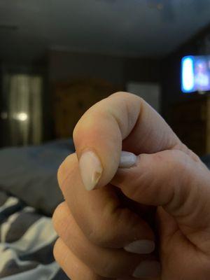 Chipped nail