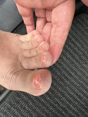 "Fresh" pedicure from Tranquility Nail Spa. At 50 I can say this is the worst pedicure I've had in my life.