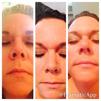 Check out some results from out amazing peels!!