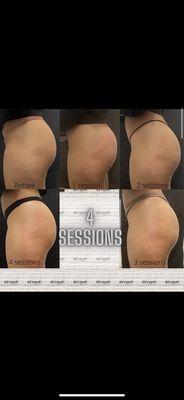 4 sessions