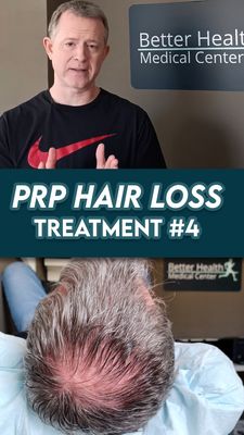 PRP for hair loss is created using your body's own regenerative blood factors, so there is no risk of allergic reaction.