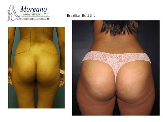 Moreano Plastic Surgery