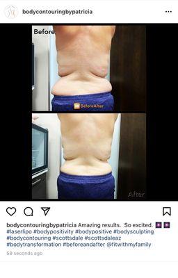 Check out these amazing results after just 3 treatments