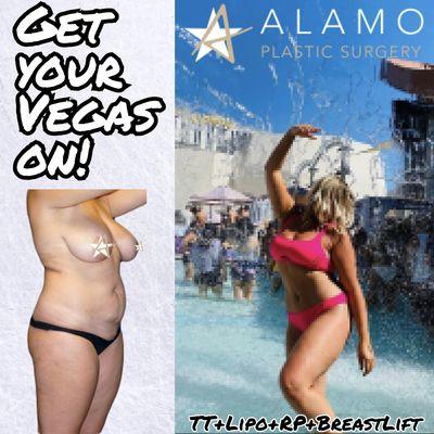 Alamo Plastic Surgery