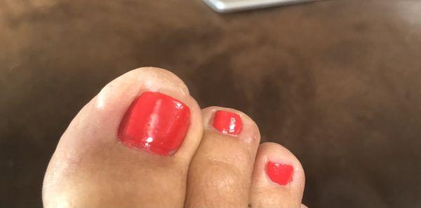 7/30/21 - Four days after pedicure - bubble moving to left side of big toe