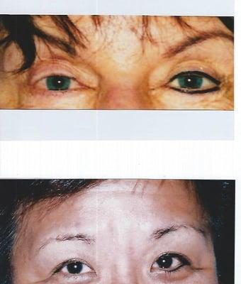 Before and after photo of permanent eyeliner