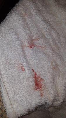 Blood on the towels