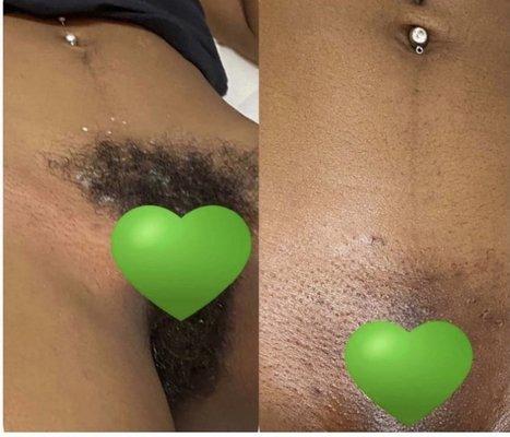 Brazilian wax