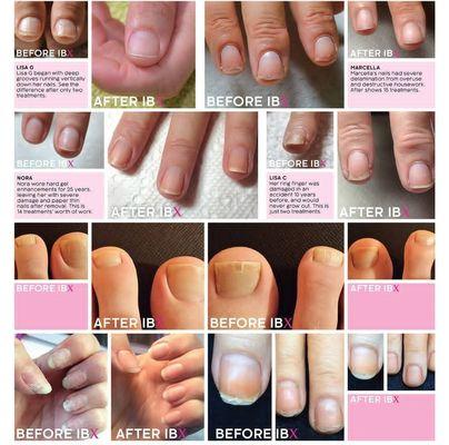 IBX Nail Repair and Strengthening System