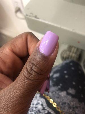 Poor cuticle and gel paint job.