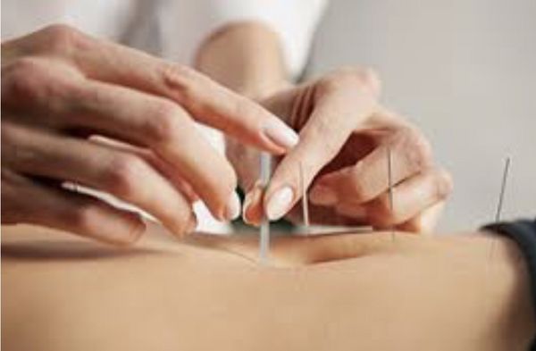 Acupuncture for digestion and weight loss