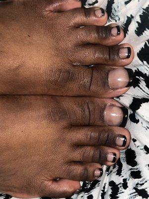 Botched toes