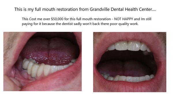 This work was done at Grandville Dental Health Center.