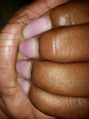 2 weeks later all nails lifting