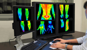 Thermography: Medical Imaging without Radiation