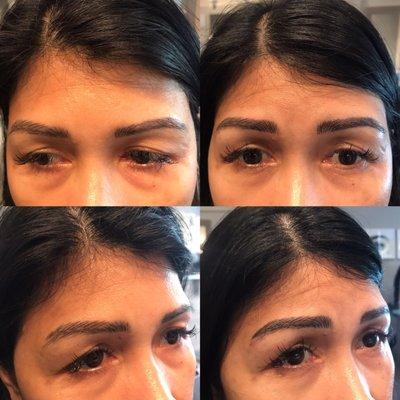 Before|After microblading