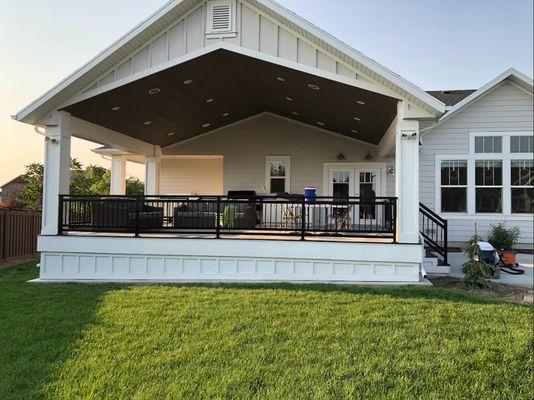 Black Aluminum Railing with Picket Infill.