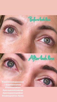 Lash line enhancement (permanent makeup)