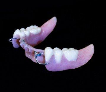 Partial Denture